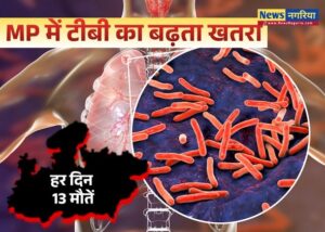 MP में टीबी का बढ़ता खतरा