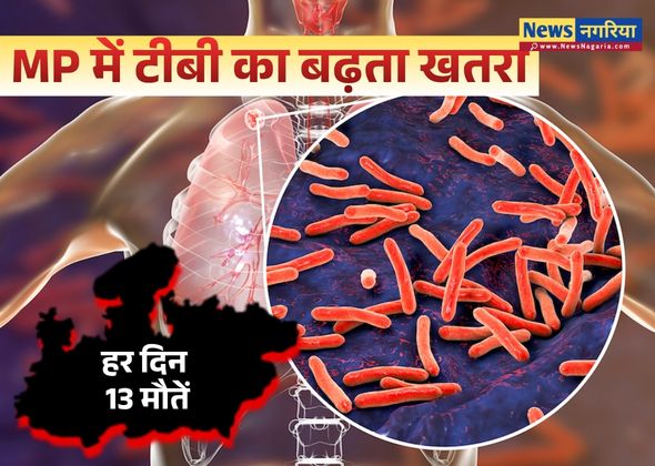 MP में टीबी का बढ़ता खतरा